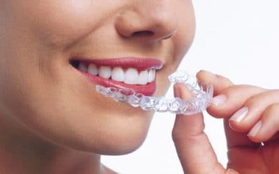 What Can Invisalign Treat?