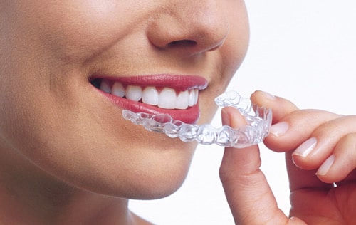 Is Invisalign Treatment Safe?