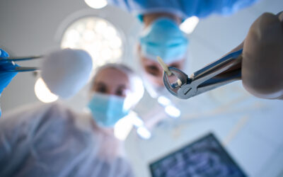 What to do after a wisdom tooth extraction