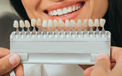 Is Professional Teeth Whitening Damaging For Your Teeth?