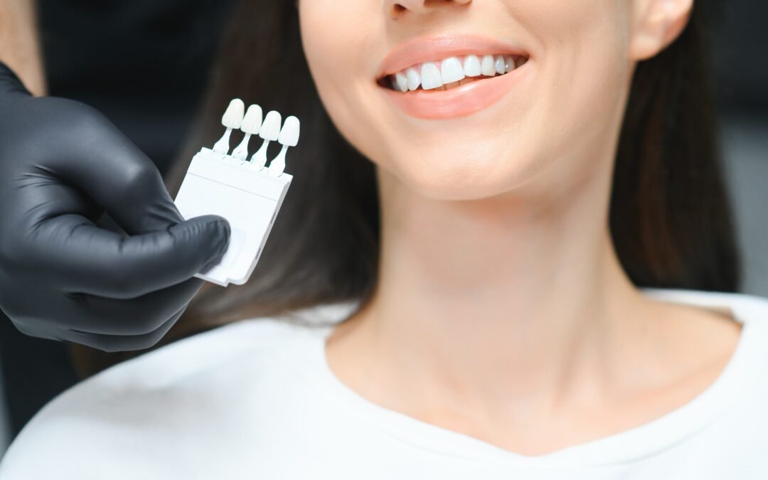 Teeth Whitening: The Myths