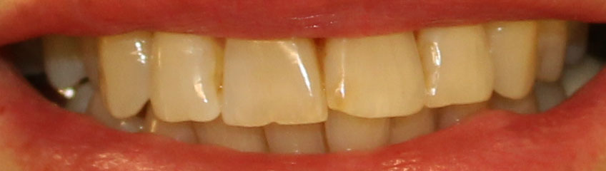 Smile before dental treatment