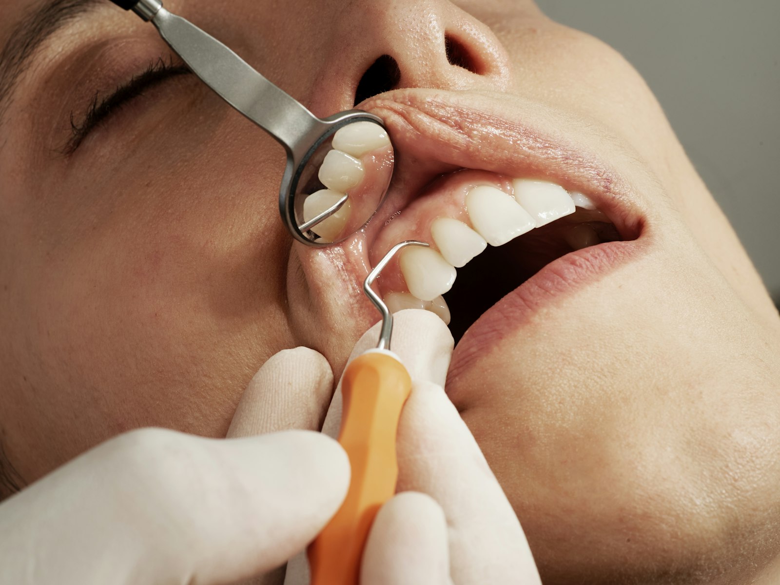 Dental exam with mirror and tool