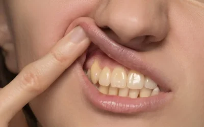 How To Get Rid Of Yellow Teeth