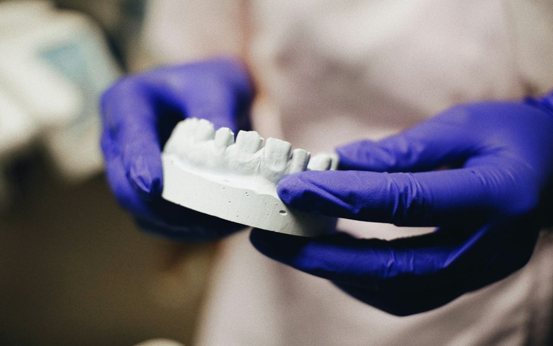 Are White Tooth Fillings Better Than Silver Fillings?