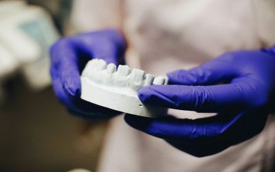 Are White Tooth Fillings Better Than Silver Fillings?