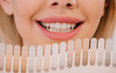 Is It Legal for Anyone to Offer Teeth Whitening Treatment?