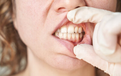 Will Receding Gums Grow Back?