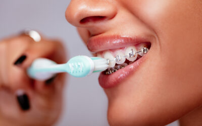 How to Brush Your Teeth While Wearing Braces