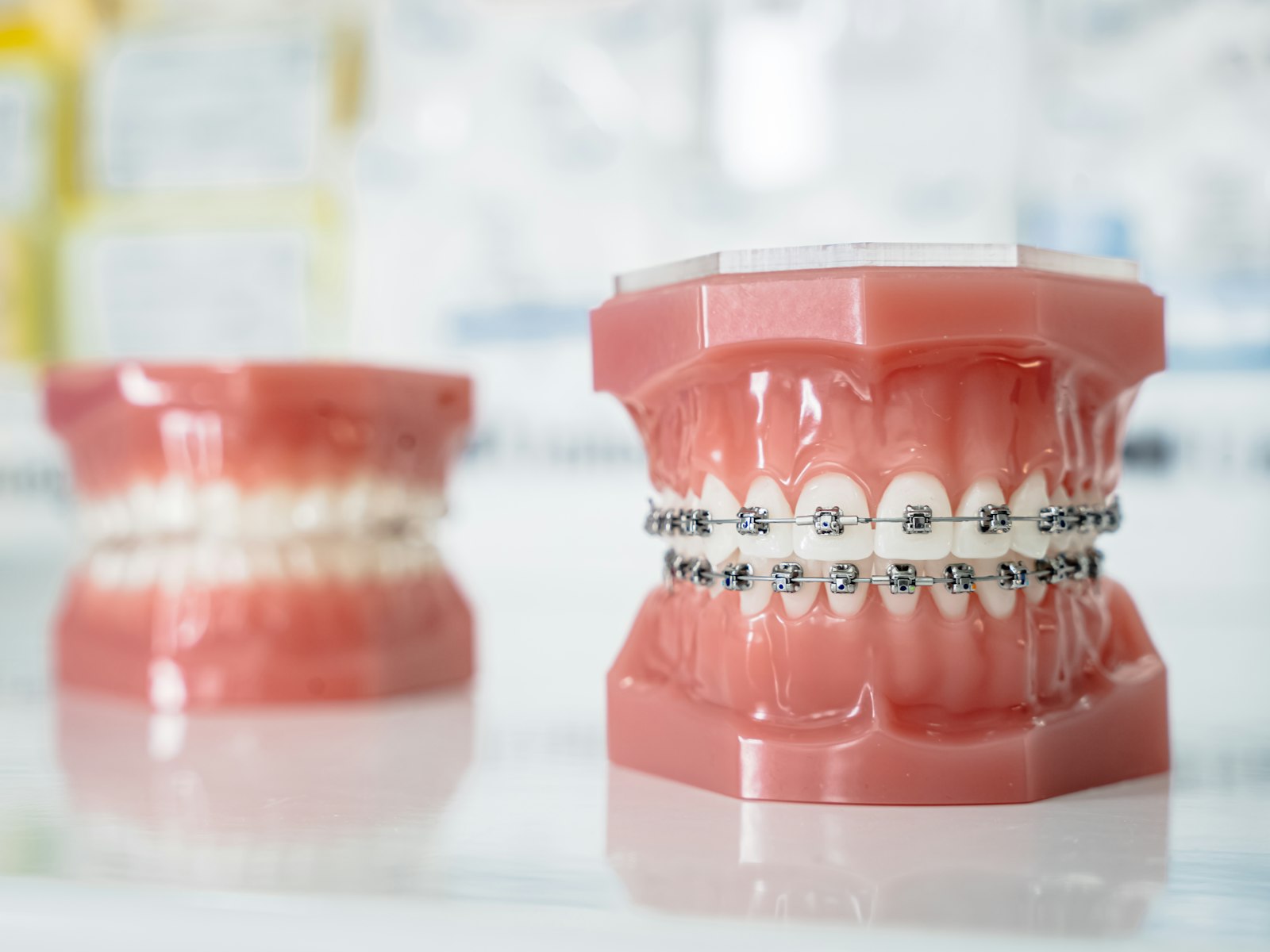 A close up of a tooth with braces on it