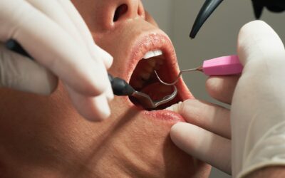 What Missing Routine Dental Appointments Could Mean for Your Health