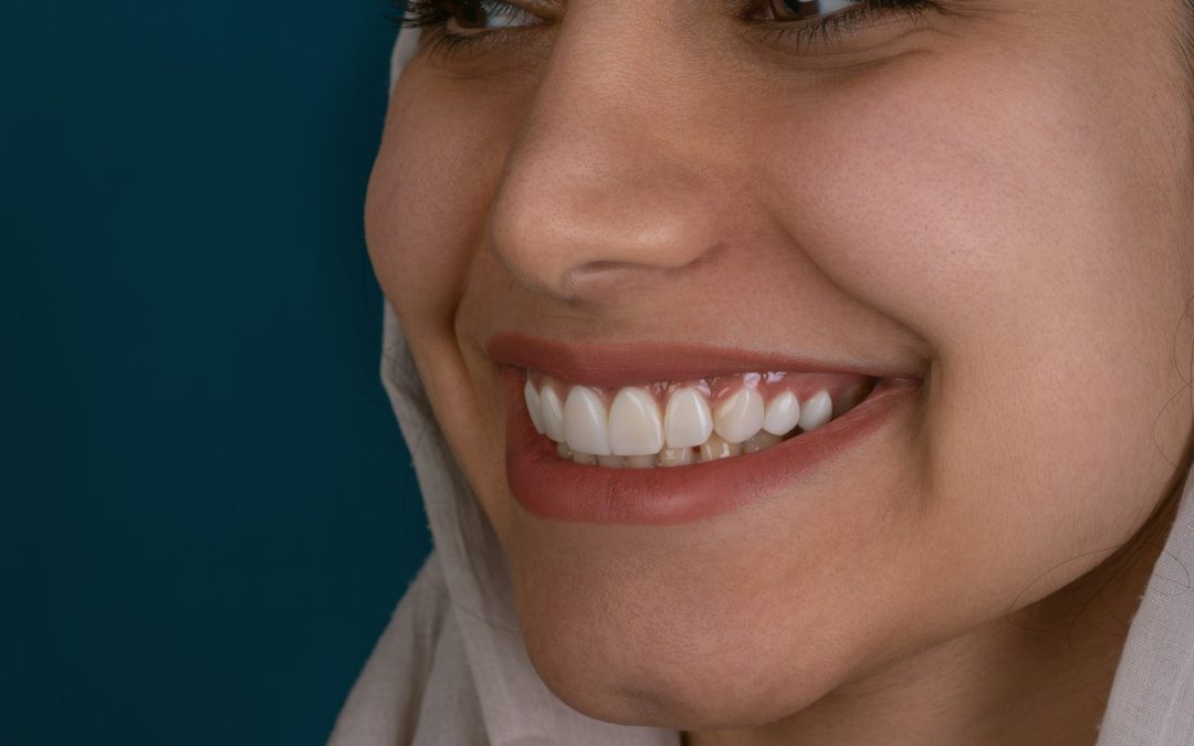 Why Composite Bonding is a New Era for Dental Treatment