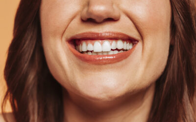 Why Composite Bonding is a New Era for Dental Treatment