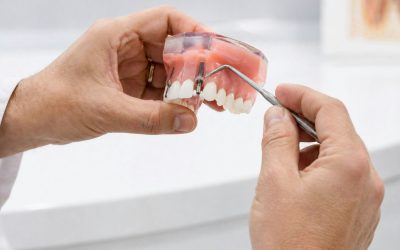 What Is an Overbite and How Can Orthodontics Correct It?