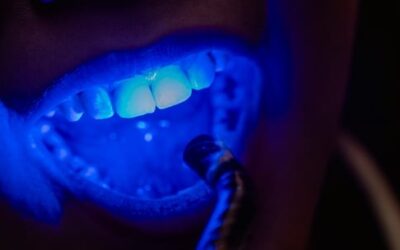 How Long After Teeth Whitening Can I Eat Normally?